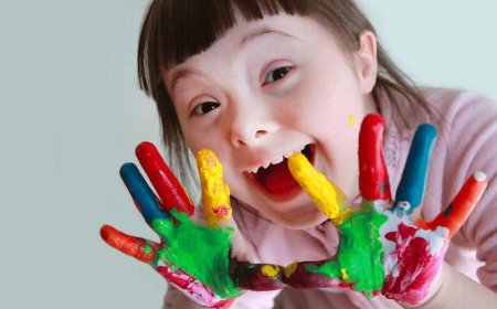 Intellectual disability and the scale of its severity