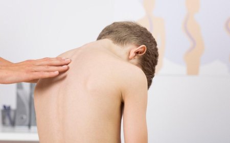 Treatment of scoliosis in children - learn more about it!