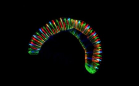 This organism can also be present in your mouth.