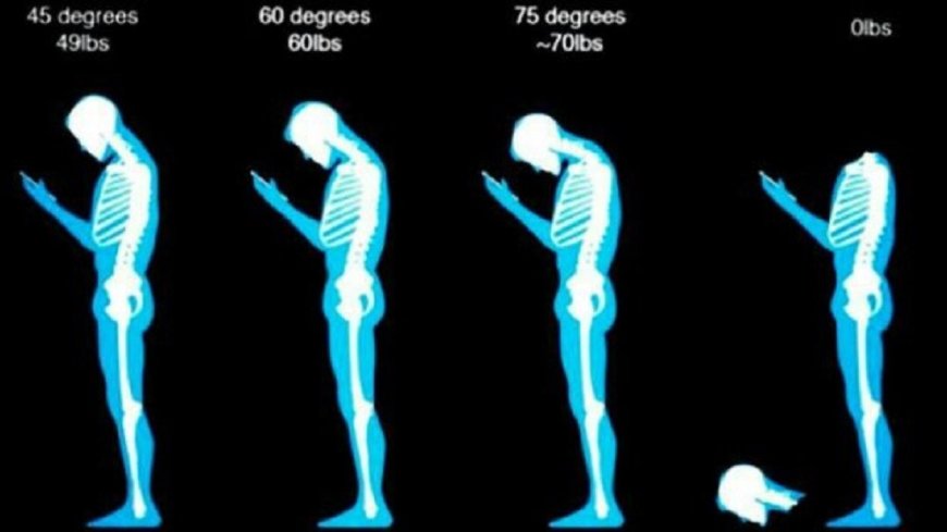 Tech neck: why is it created and how can it be prevented?